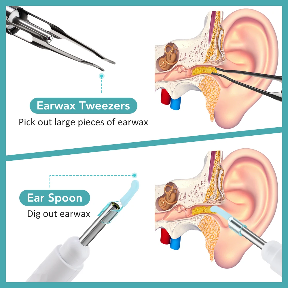 منظف شمع الأذن البصري الذكي 2  - مراجعة Endoscope Inspection Camera وسعره